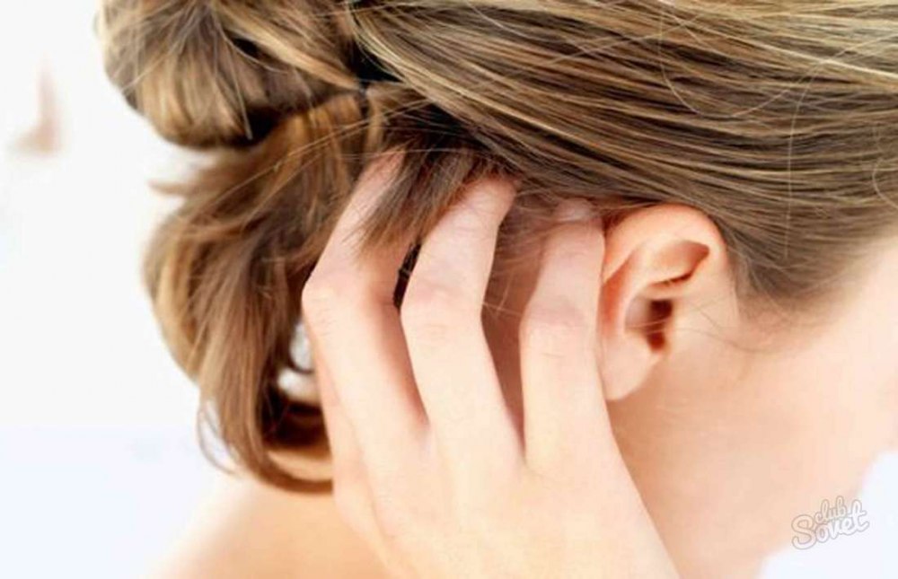 Как вылечить перхоть и зуд головы и выпадение волос thumbnail
