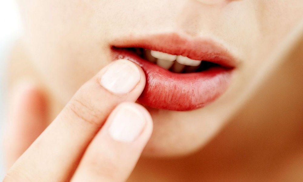 Как быстро вылечить простуду на губе и носу thumbnail